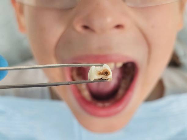 Best Weekend Emergency Dentist in Morrilton, AR